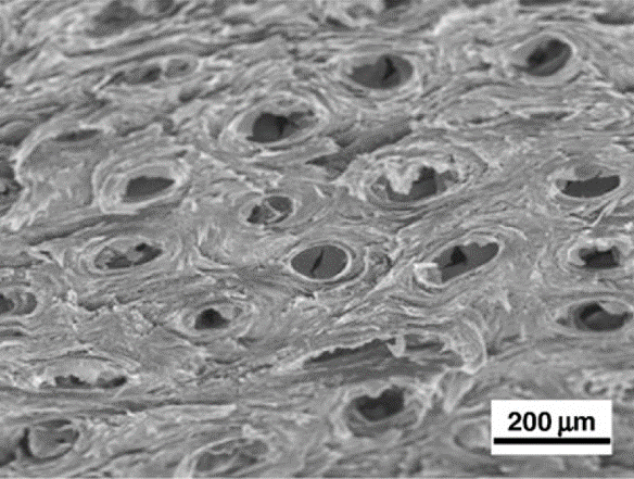 Microscopic Surface of Ram's Horn