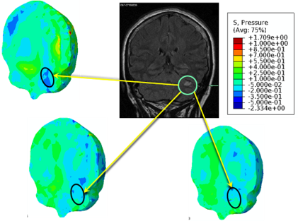 Skull X-ray and simulation