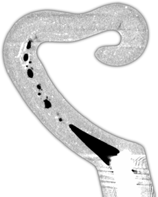 Mirco X-ray Central Cross-Section