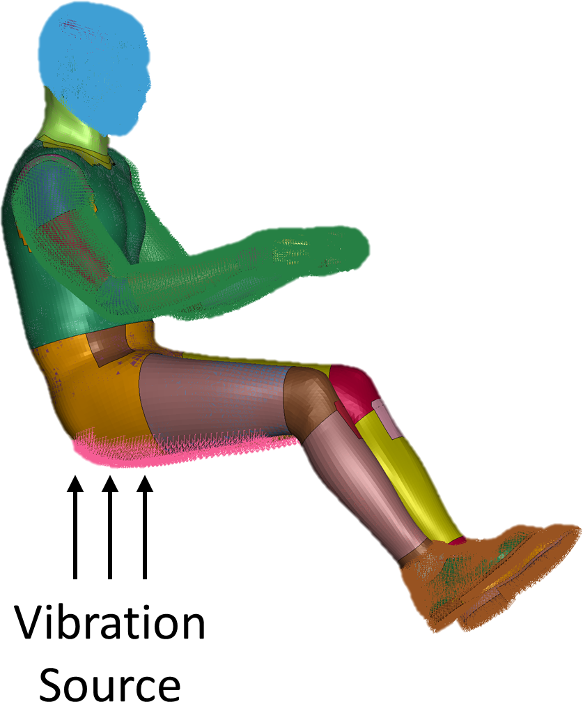 Vibration Injury